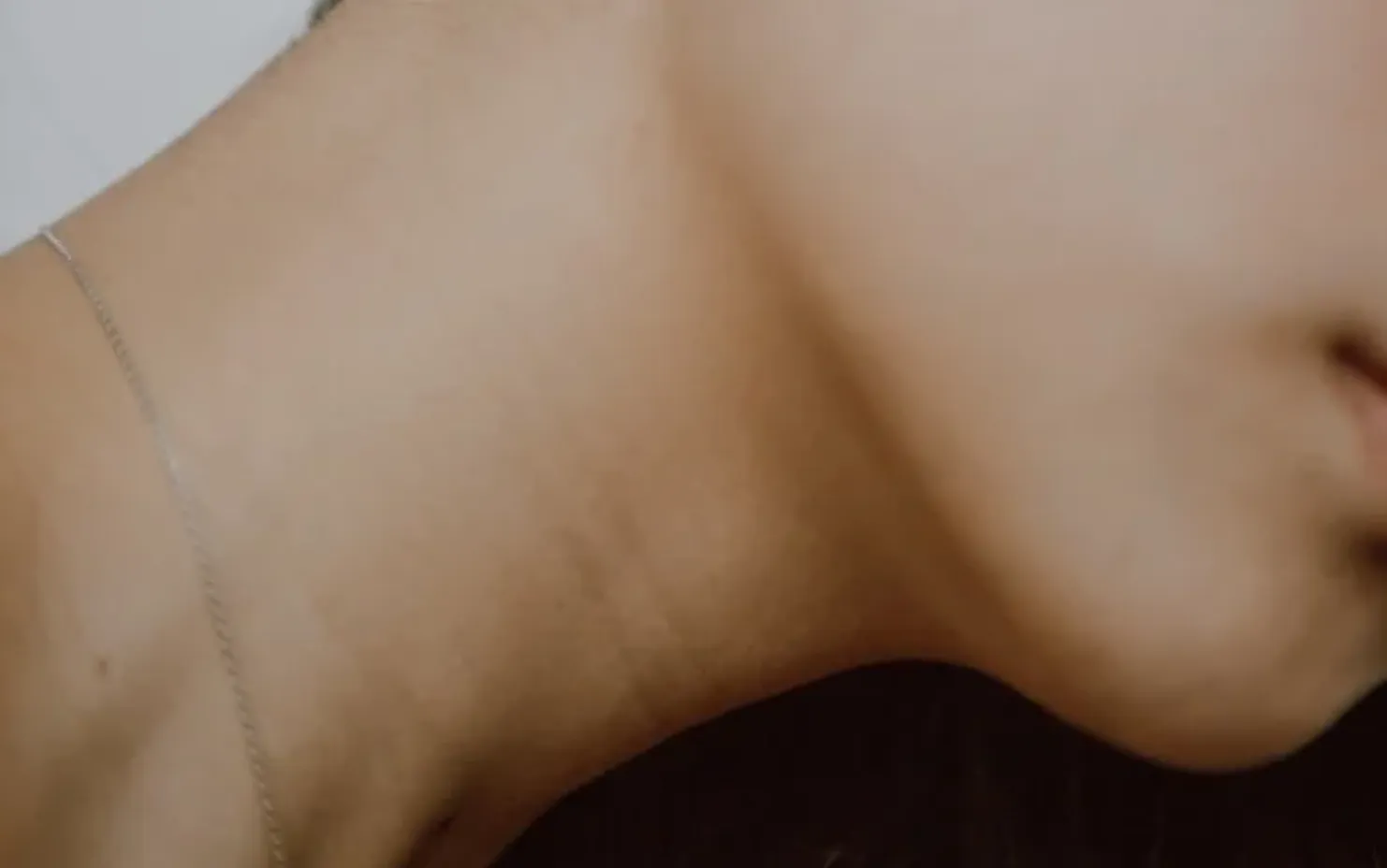 Neck bands treatment area